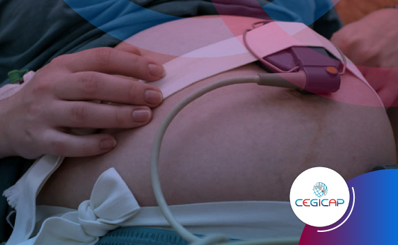 MONITOREO ELECTRONICO FETAL
