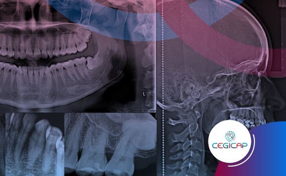 RADIOLOGIA ORAL Y MAXILOFACIAL