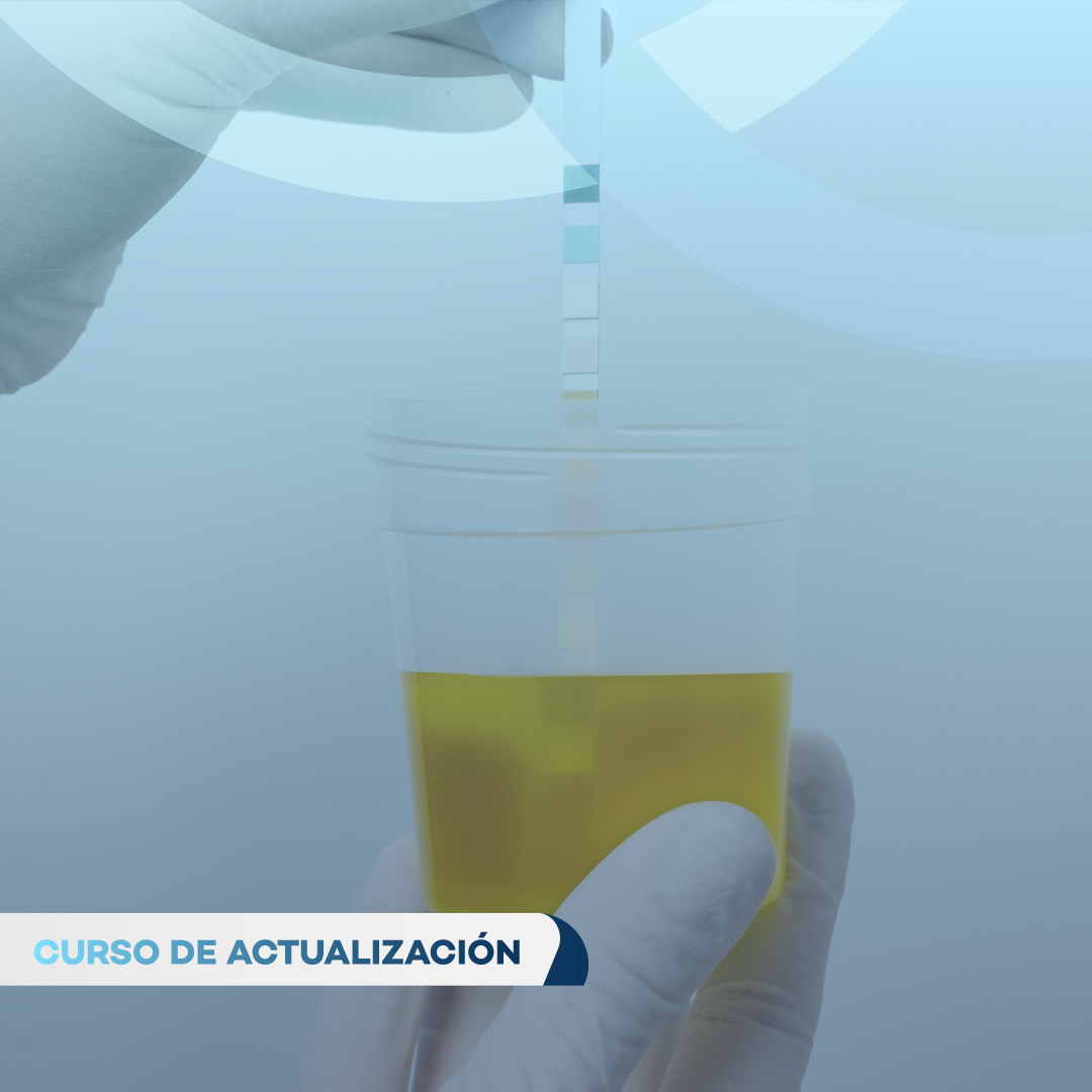 ANÁLISIS INTEGRAL DEL SEDIMENTO URINARIO LECTURA Y REPORTE