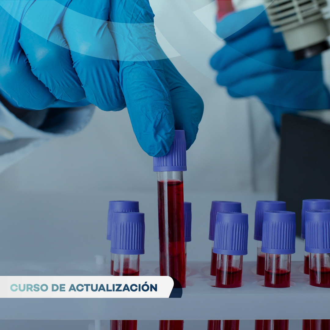 Portada de SISTEMA DE GESTIÓN DE CALIDAD DEL BANCO DE SANGRE