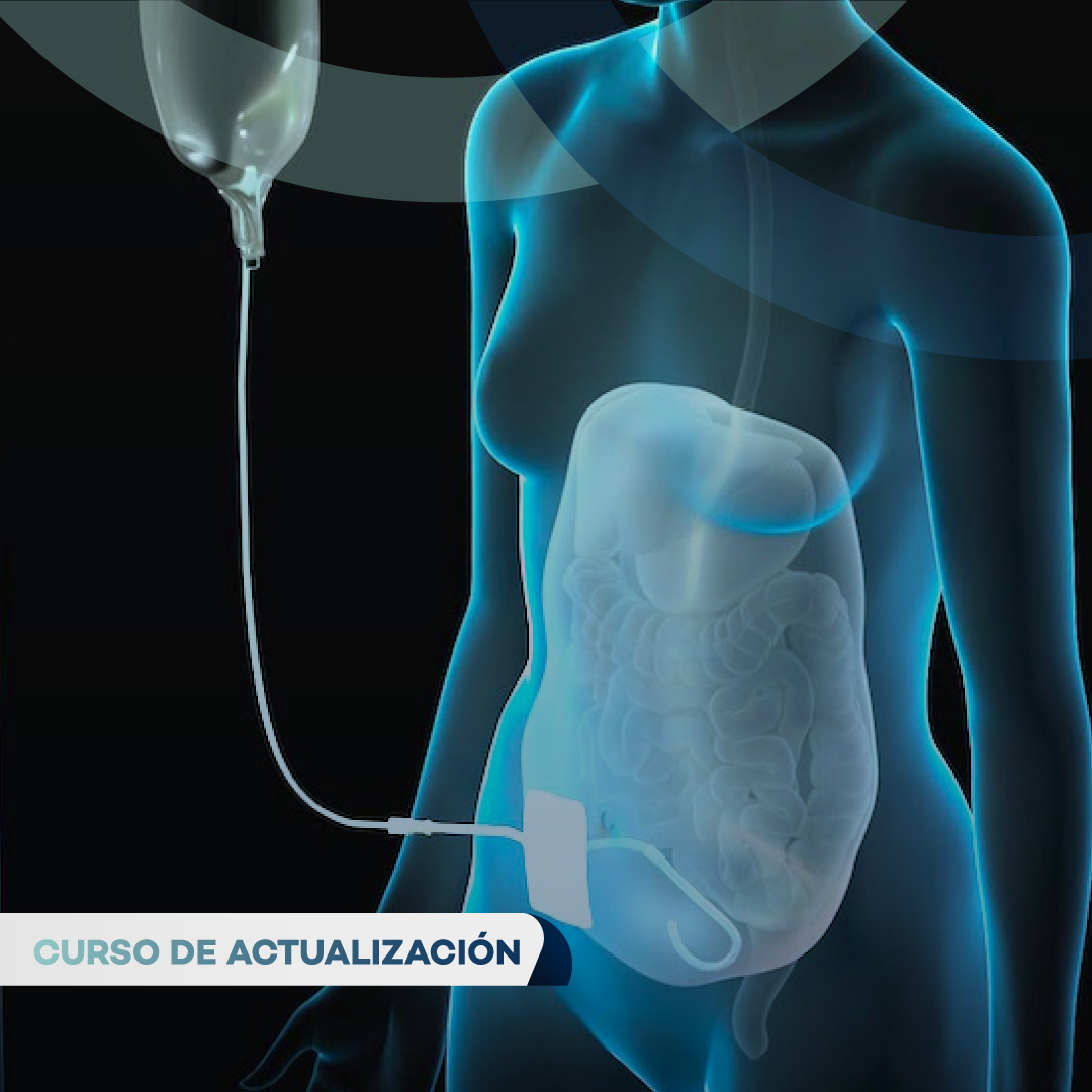 Portada de ENFERMERÍA NEFROLÓGICA Y LA DIÁLISIS PERITONEAL