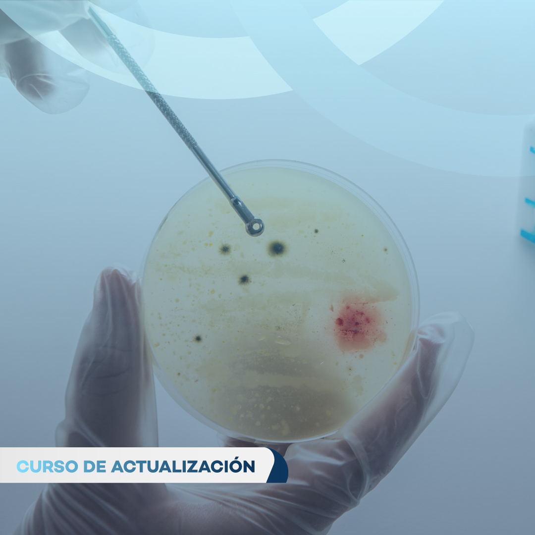 PATOLOGÍA DE LA SERIE BLANCA: LEUCEMIAS Y LINFOMAS