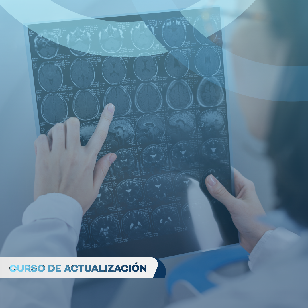 Portada de TOMOGRAFÍA Y RESONANCIA MAGNÉTICA CEREBRAL